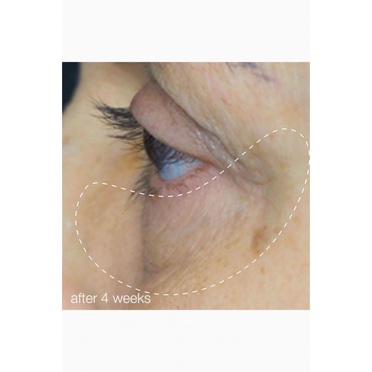 Dermalogica - Awaken Peptide Eye Gel, 15ml